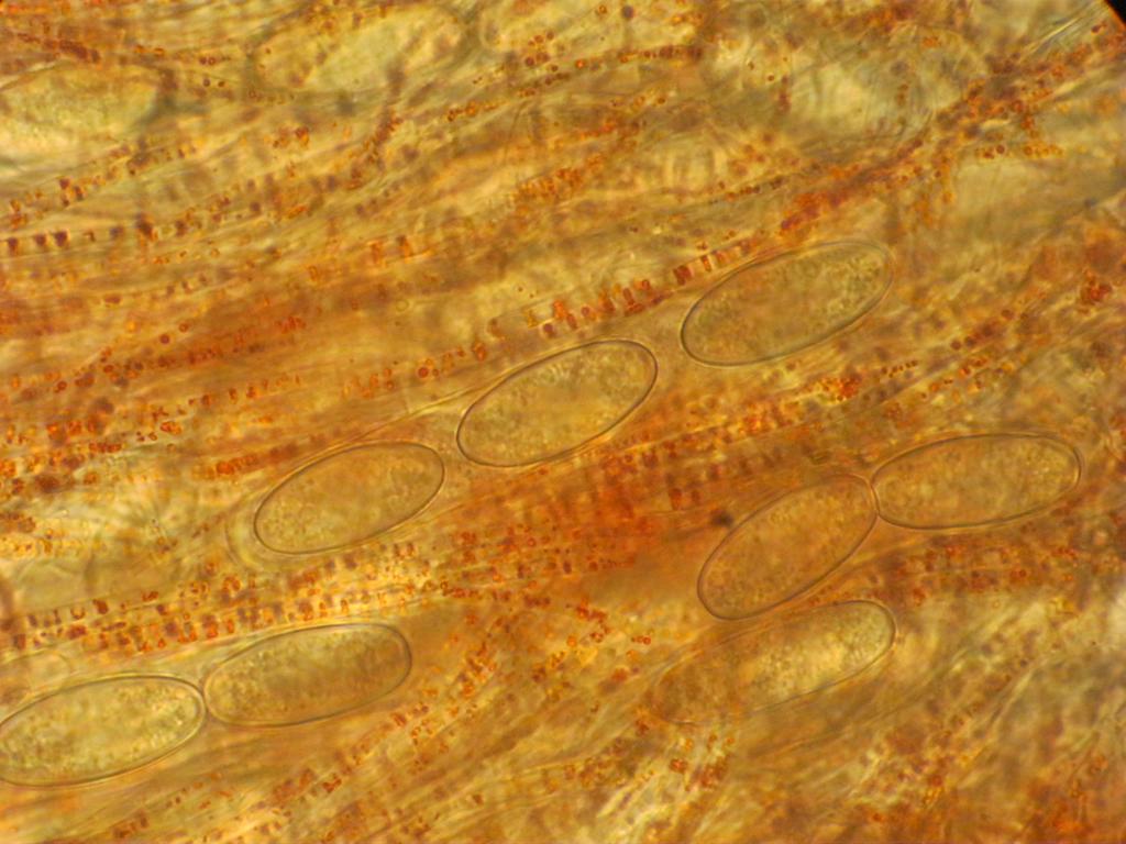 In mikroskopisch kleinen zylindrisch geformten Zellen, den sogenannten Schläuchen, befinden sich jeweils acht elliptische Sporen.